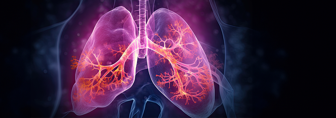 Contratación precomercial de servicios de I+D para el desarrollo de un programa de simulación evolutiva pulmonar instersticial mediante inteligencia artificial (SEPI-IA)